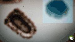 一星期不换衣服正常吗,一星期不换内裤危害