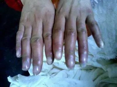 药店里几毛钱的药膏,竟能缓解治疗12种常见病痛!不看亏大啦~