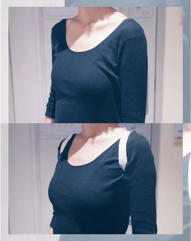 防驼背矫正神器步骤,纠正驼背神器视频