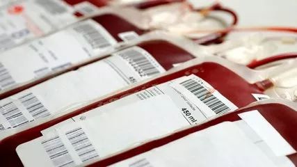 为什么亲属不能互相输血,直系亲属之间不能输血是真的吗