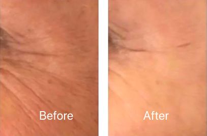 十五年恍如隔世,15年少女时代回归