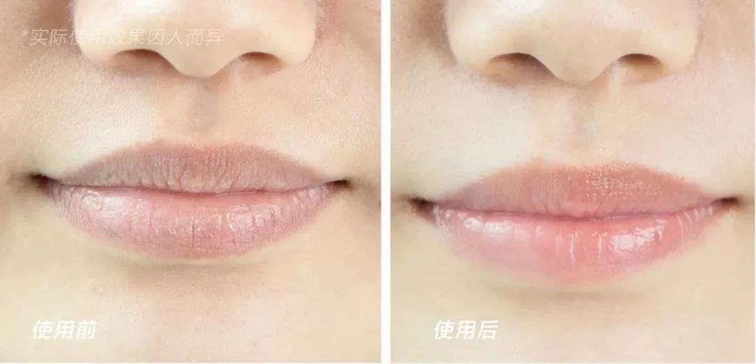 唇干去死皮的唇膏,干唇星人的急救小能手