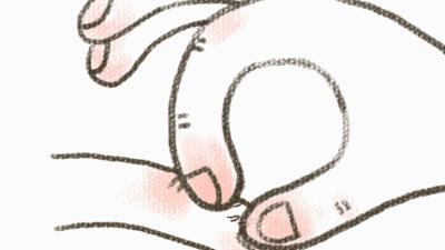 一个没注意，手指倒刺变截指！