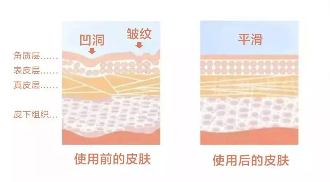 淡纹抗皱法令纹面膜推荐,法令纹面膜平价推荐