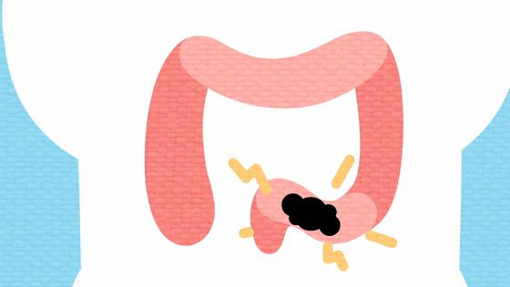 便秘是怎么回事能看好吗,便秘的表现与症状怎么解决