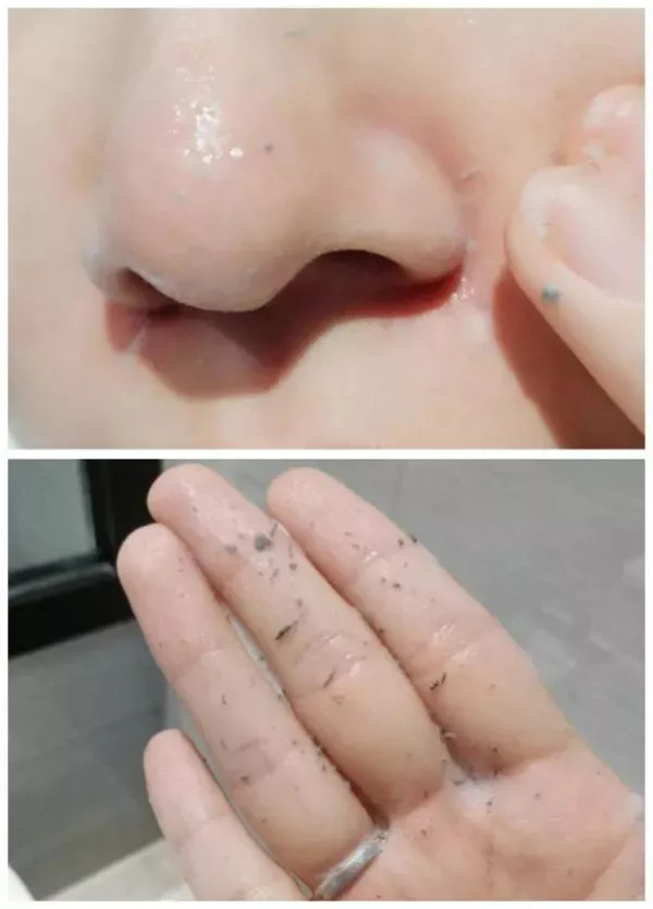 去黑头去角质慕斯,3分钟祛除黑头