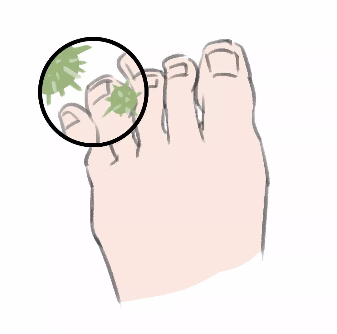 医生头皮痒是怎么回事,请问医生皮肤痒怎么办