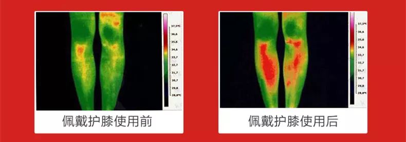 护膝保暖老寒腿自发热磁疗,自发热护膝磁石