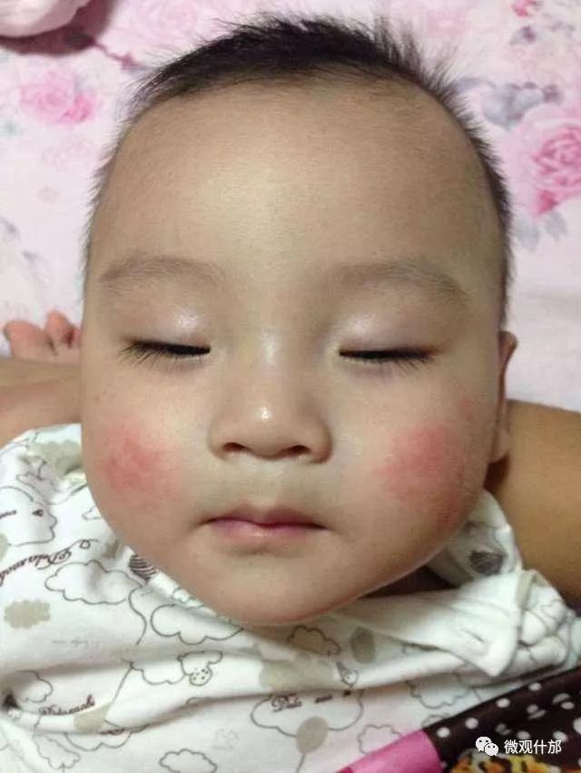 肠胀气哭闹妈妈崩溃,吐奶和肠绞痛