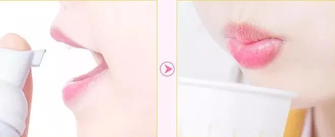 闭着嘴巴一直有口水,闭着嘴巴往外呼气的时候有臭味