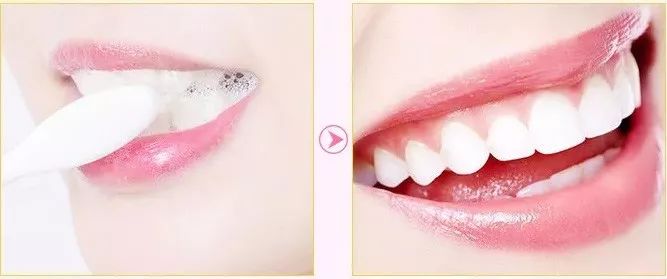 闭着嘴巴一直有口水,闭着嘴巴往外呼气的时候有臭味