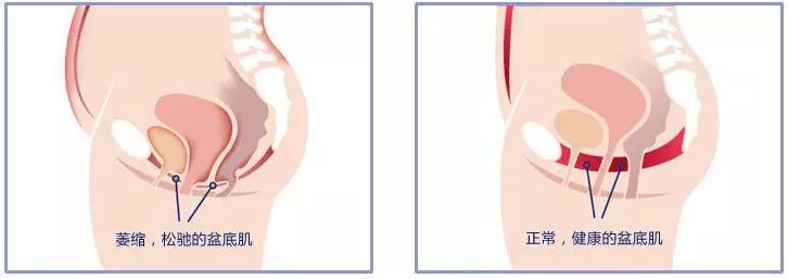 在昌吉，产后修复，到底得花多少钱？