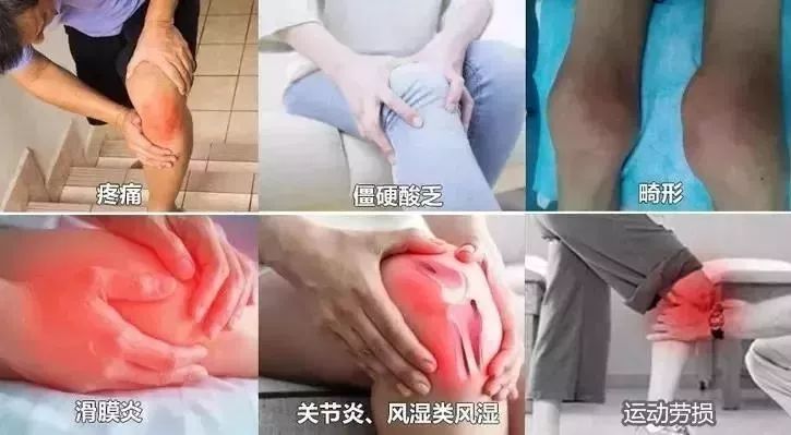 告别老寒腿护膝,老寒腿专用护膝运动