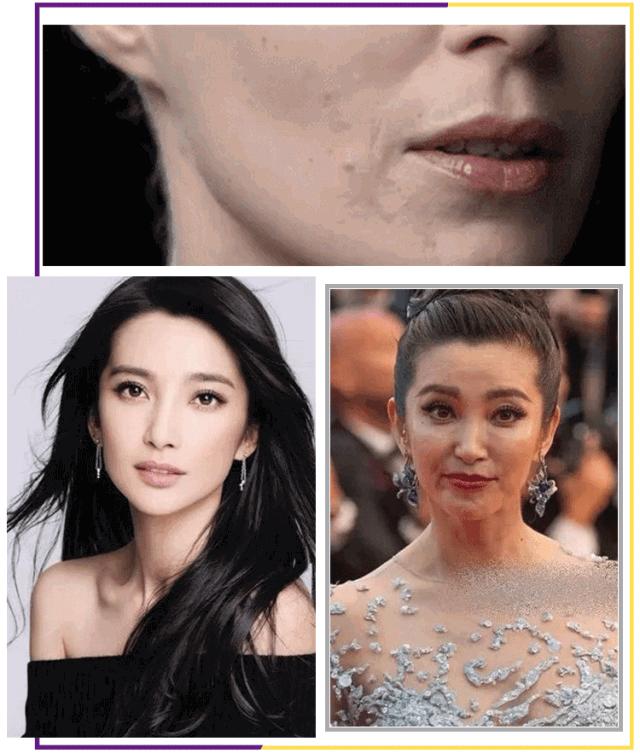 一分钟提拉紧致去除眼袋皱纹,修眼袋祛皱纹神器