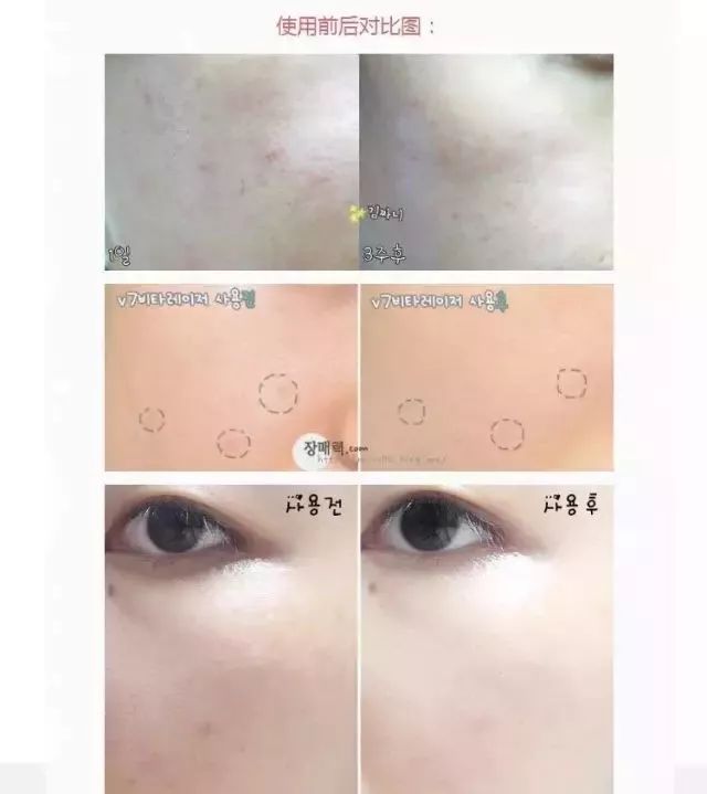 一支“激光霜”帮你解决众多困扰~