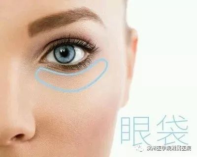 眼袋小贴士效果怎么样,眼袋下面的脂肪粒怎么形成的