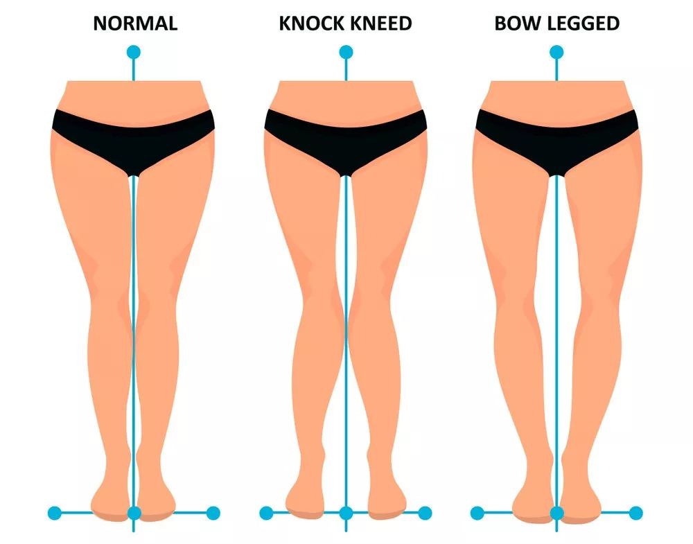 3个让人变丑的动作,让人变丑的几个姿势