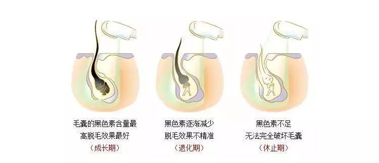 头等大事脱发青年自救指南,秃头女孩必看6大脱发误区