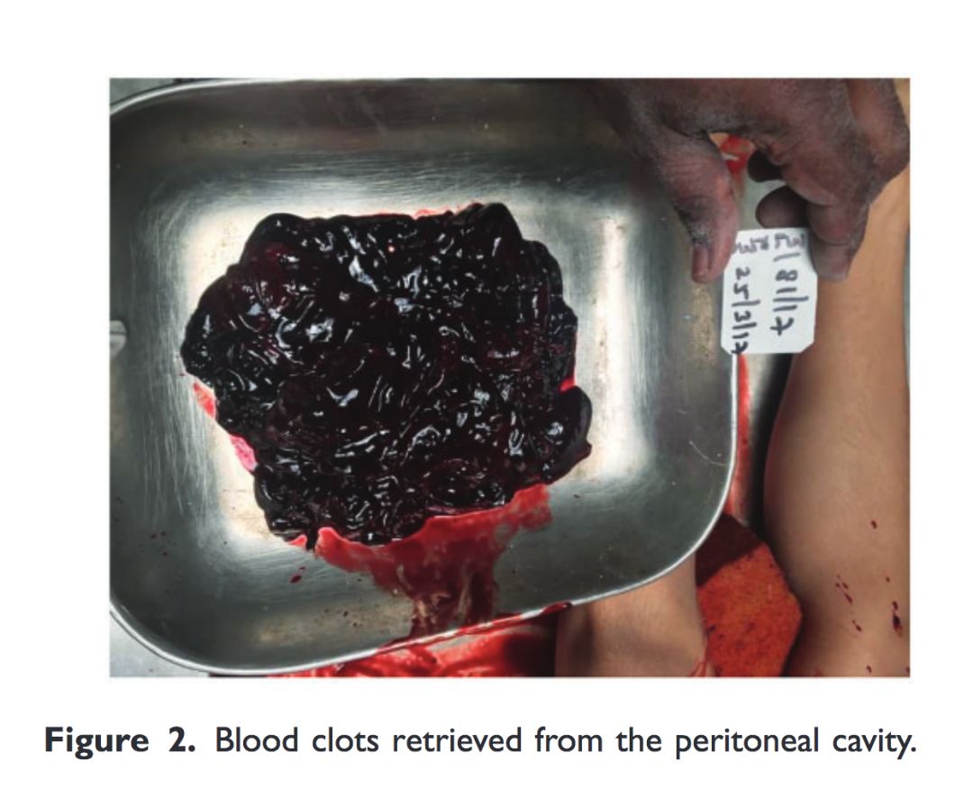 聊聊怀孕这些事,怀孕这件大事儿