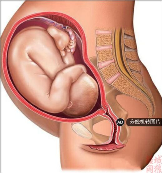 月子期间要做盆底肌修复吗,月子里可以用盆底肌修复吗