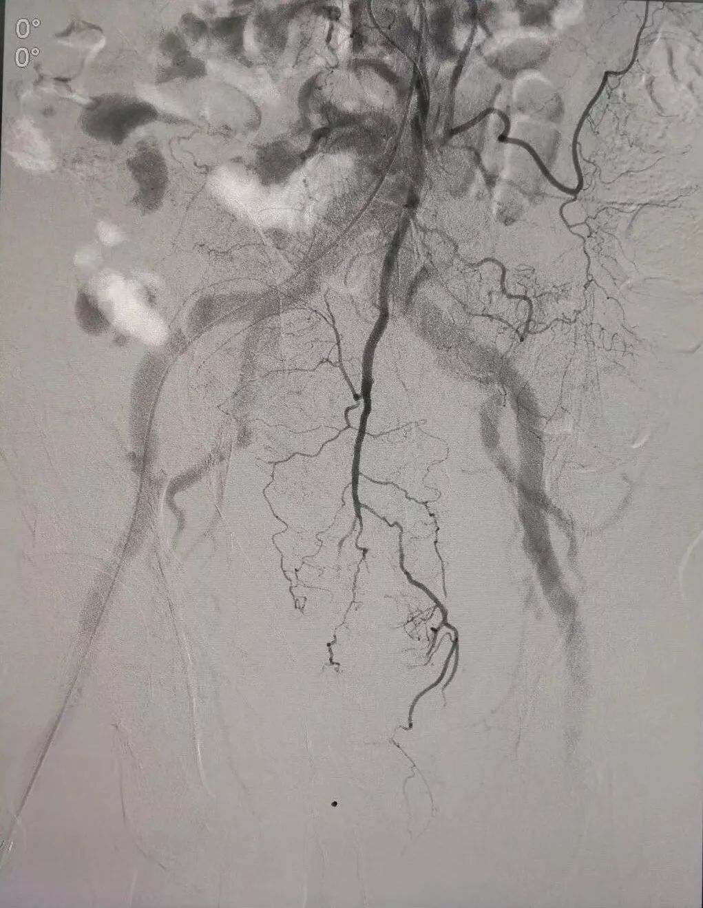 运城市第一医院肿瘤科咋样,运城第一医院治疗肿瘤怎么样