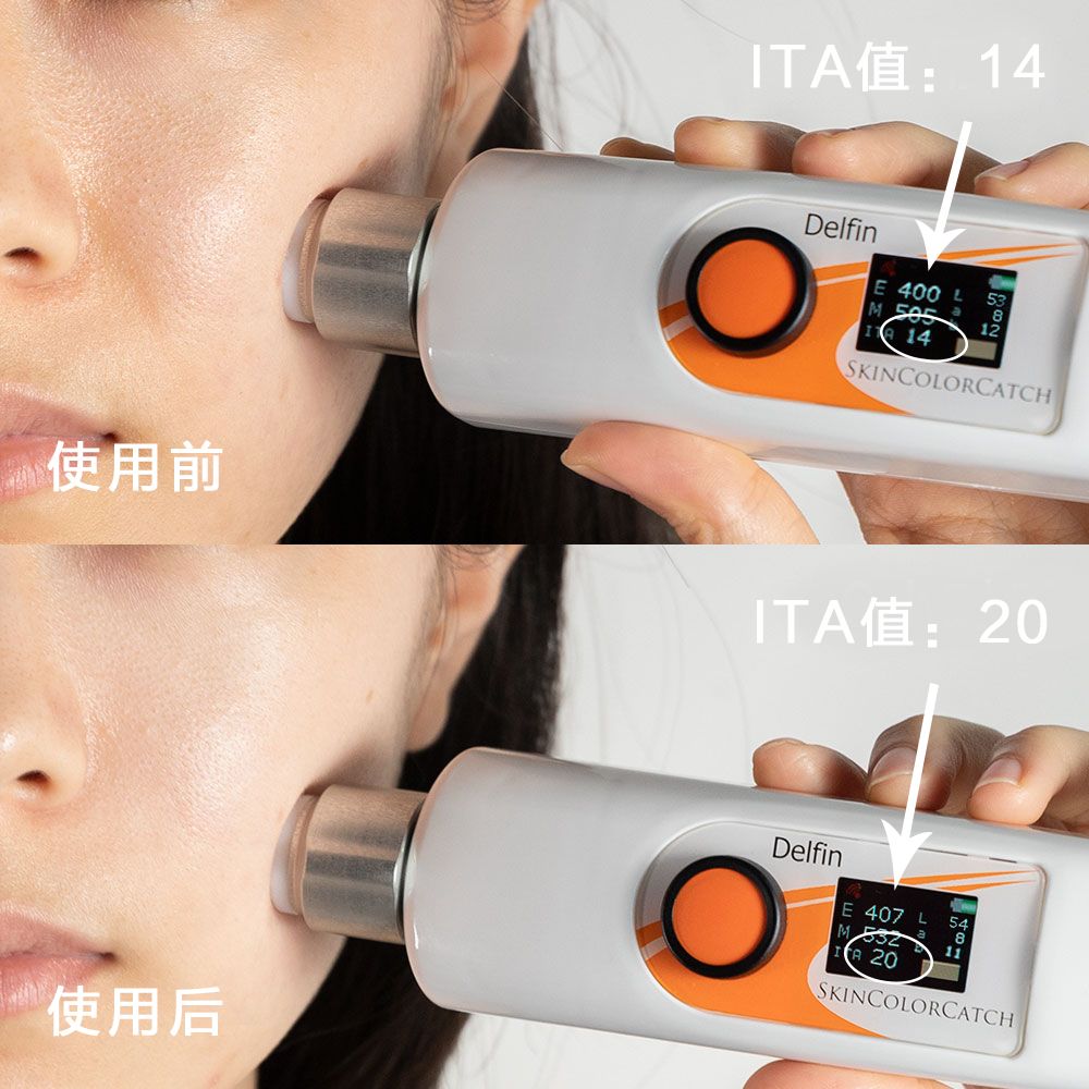 袁姗姗秦岚对比照,袁姗姗秦岚对比图片