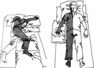 卒中康复哪种打开方式最好,卒中康复终止训练的情况有哪些