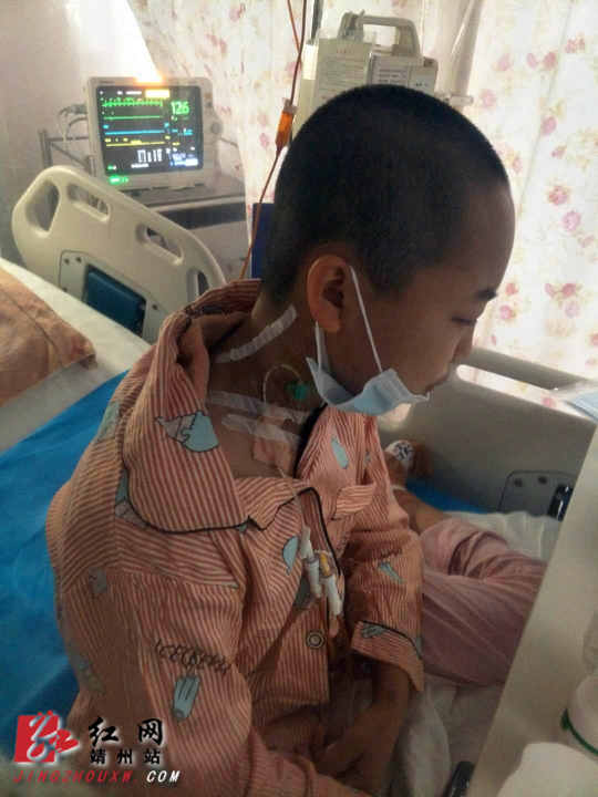 地贫女孩移植,地贫移植术后排异