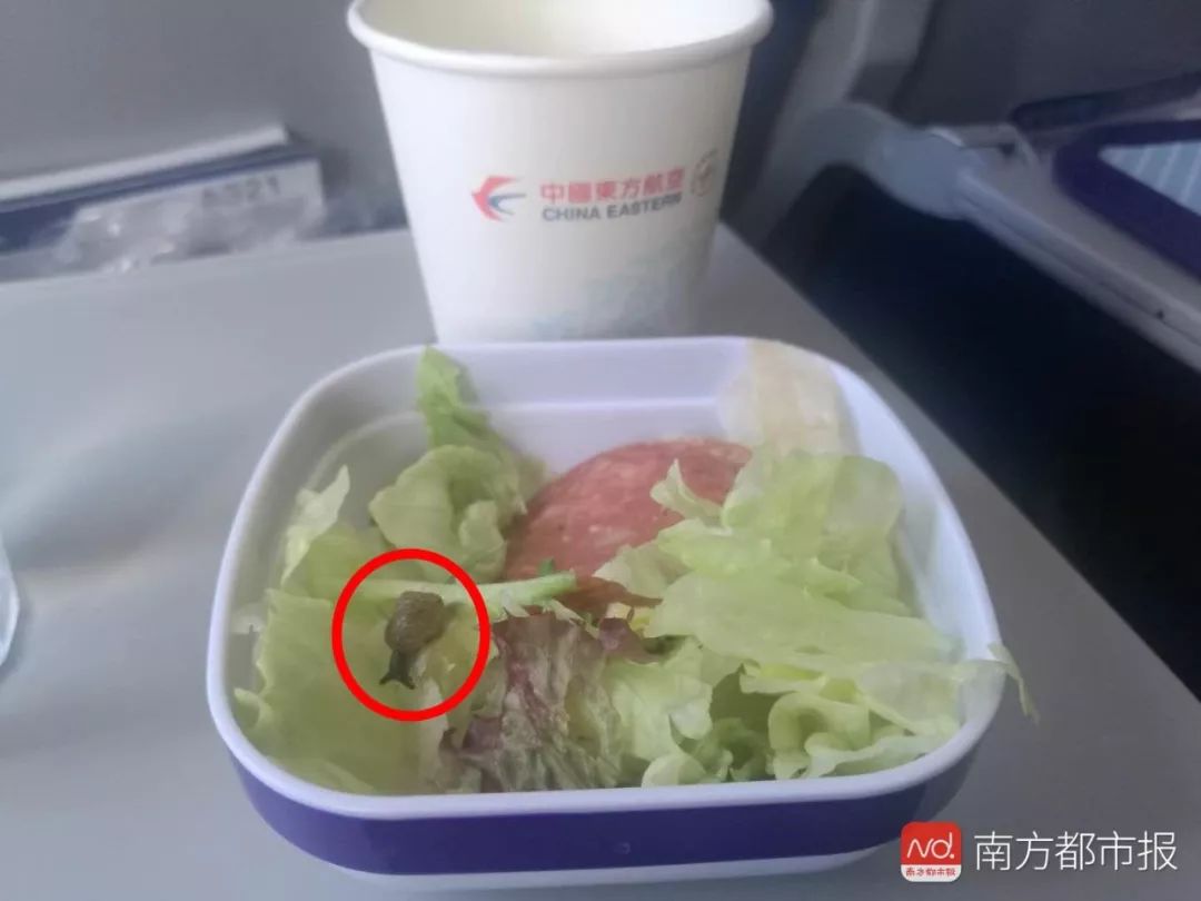 剖宫产手术取出孩子,剖腹取纱布