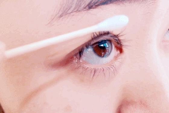 疯狂掉头发发际线后移,疯狂掉头发头发变得稀疏