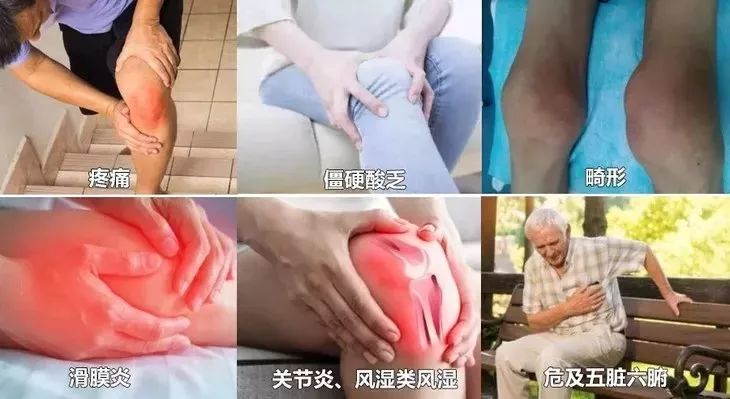 「周三爆款返场」你们要的酸痛大师台湾一条根，来喽