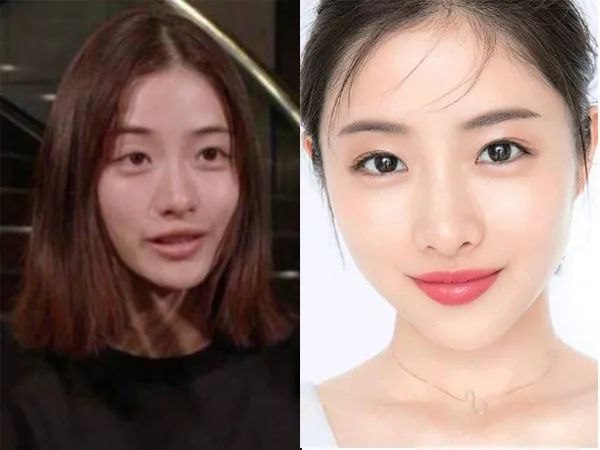 怎么调整眉眼距,怎么样才能增加眉眼间距