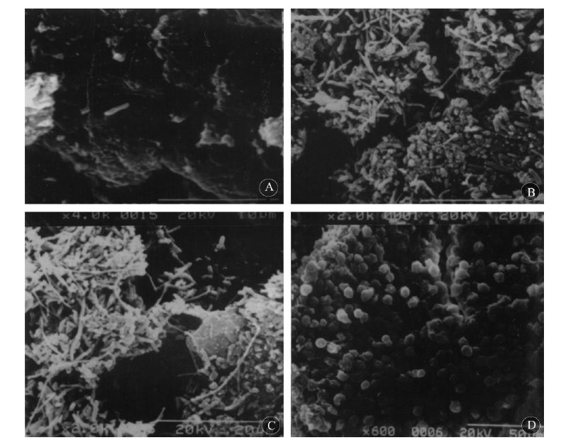 间歇性导尿会引起膀胱炎吗,儿童间歇性导尿插管
