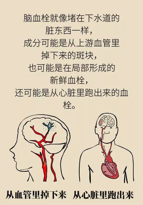 微针取血栓骗局视频,微针取血栓是国家认可吗