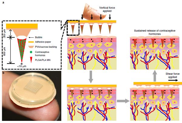 避孕贴片是用一层纸还是一层皮的,避孕贴片的正确使用方法