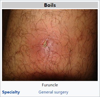 为什么体温计到42c了,为什么体温计刻度42