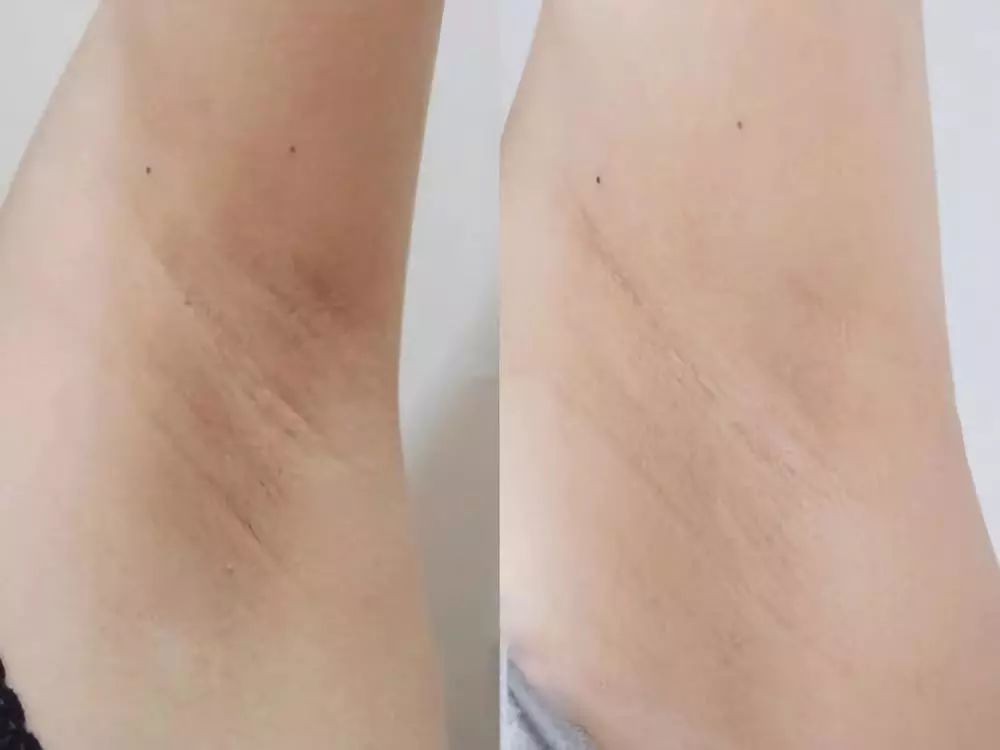 精致从头到脚,细节展现气质,一块嫩红皂让你6周变粉嫩少女!