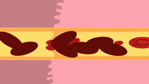 炒菜废油倒进水池,厨房废油可以倒水槽吗