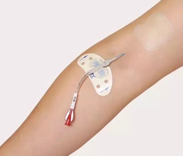 picc静脉置管维护挂哪个科好,picc置管后有什么注意事项