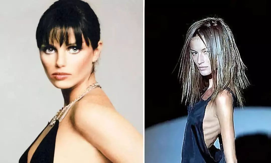 有多少人通过节食和抽脂减肥,抽脂与节食根本上有何差异