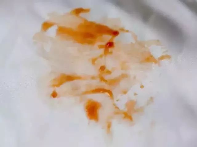 羽绒服脏了怎么局部干洗,羽绒服脏了怎么干洗最好