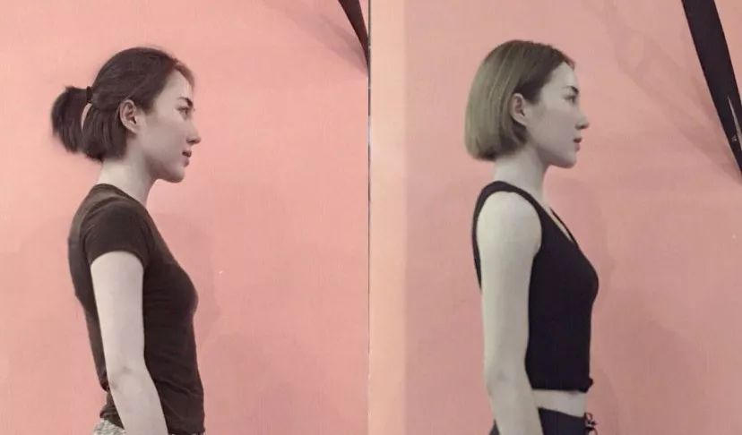 久坐相当“慢性自杀”!德国骨科专家打造的“撑腰”神器,坐9小时腰也不痛,20年颈脊椎病都好了