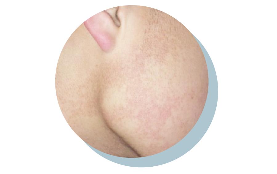 一直在长闭口,为什么总愿意长闭口