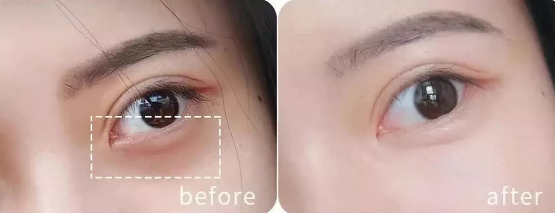 韩国牌子眼霜抗老去皱保湿,韩国平价眼霜精华全脸用的