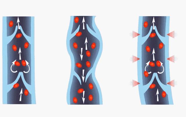 腿细翘臀神器,腿变得又细又直神器