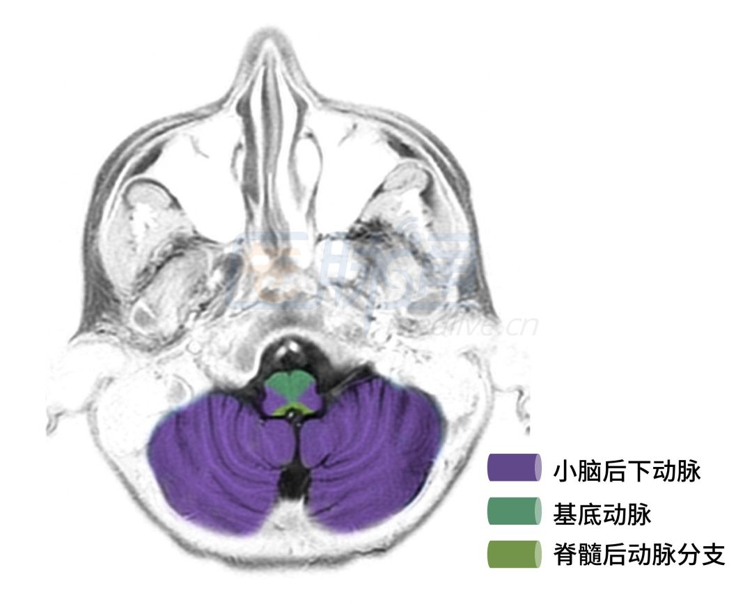 超详细脑供血系统解剖秒懂收藏级,脑动脉供血区域示意图图片