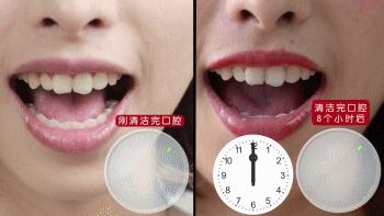 美白黄牙烟渍最好的牙膏,比洗牙还干净的美白牙膏适合牙黄