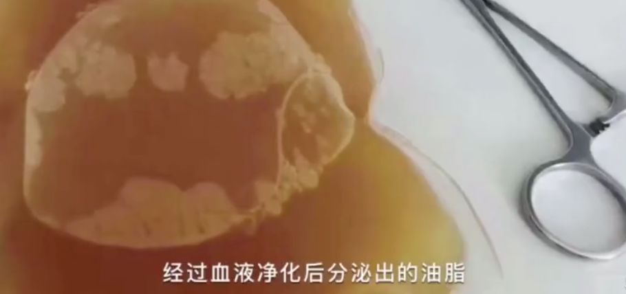 网红魔鬼减肥瘦身法,这些害人的网红减肥法你尝试过吗