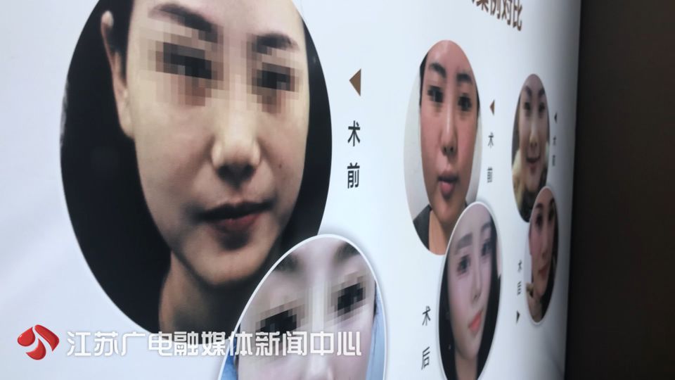 女子砸3万做“线雕”美容，却被打了这个针！更气人的是……