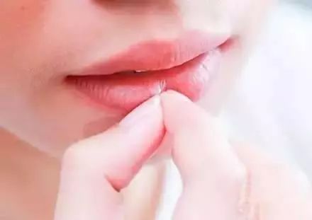 几块钱一瓶的维生素B2,横扫这些疾病!为家人收藏